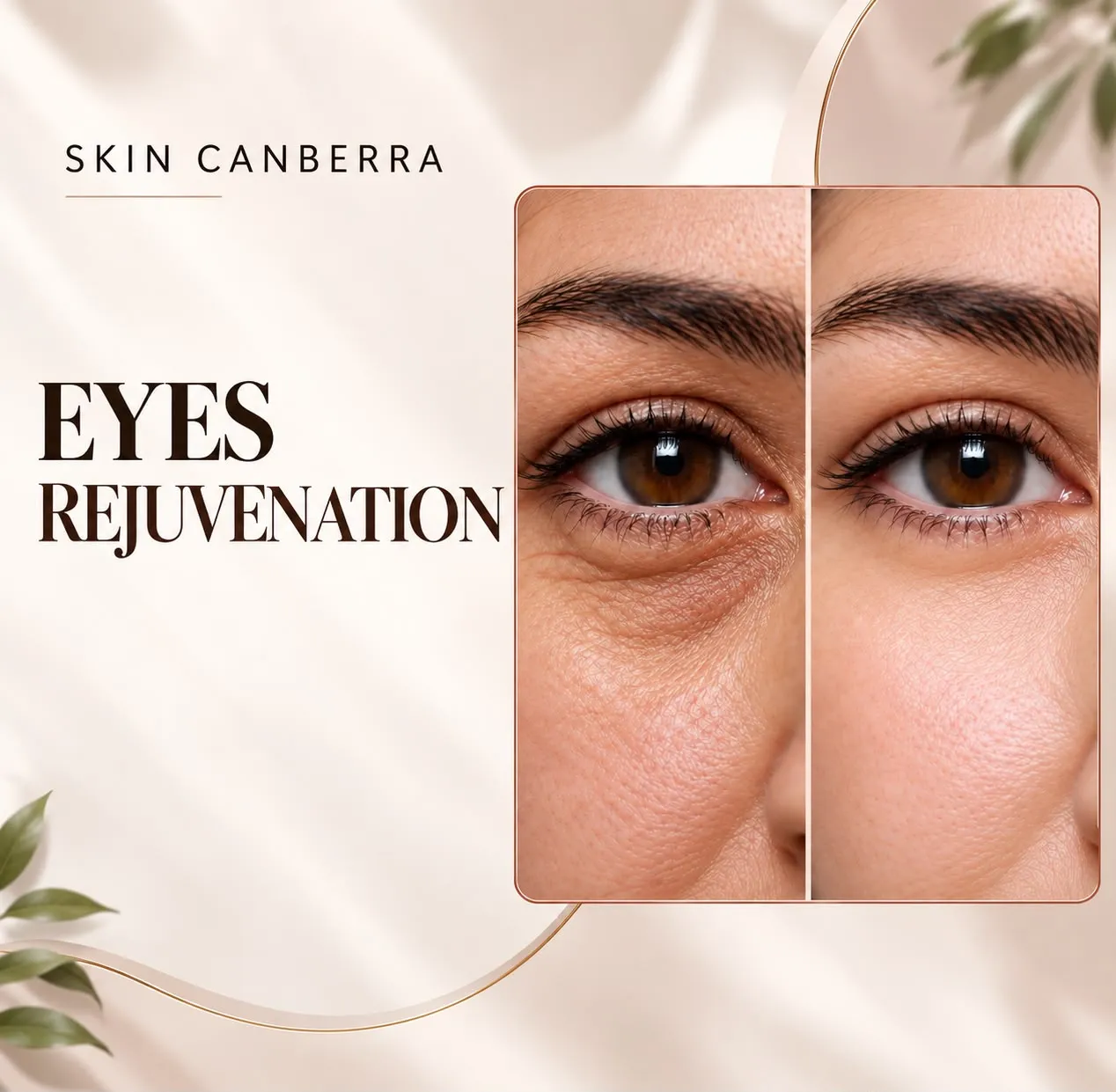 Under Eye Treatment